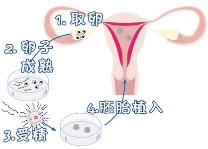 嘉和优生